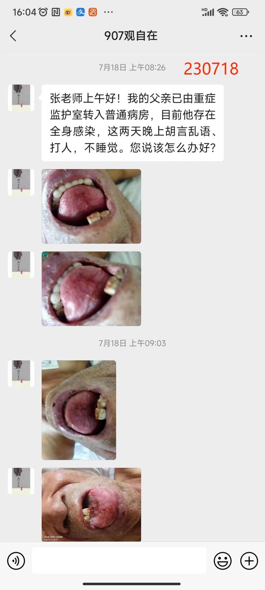 230803肺感染7