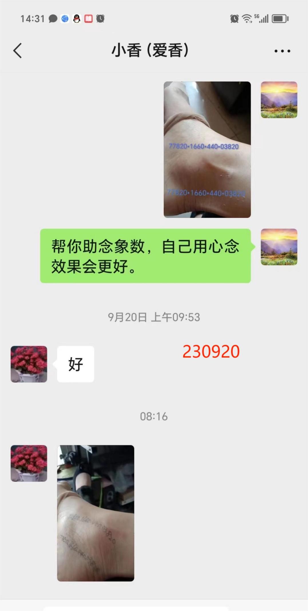 230927脚踝肿疼4