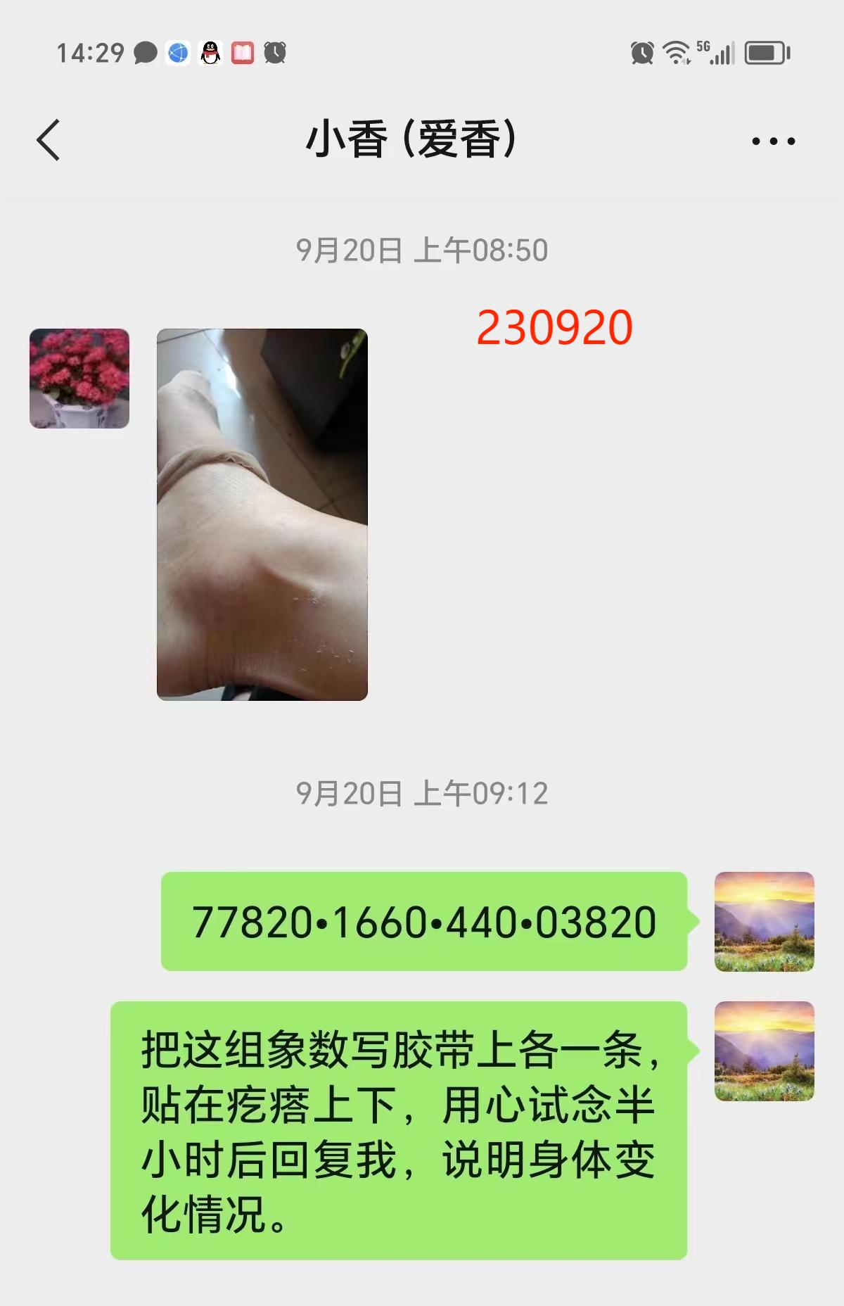 230927脚踝肿疼3