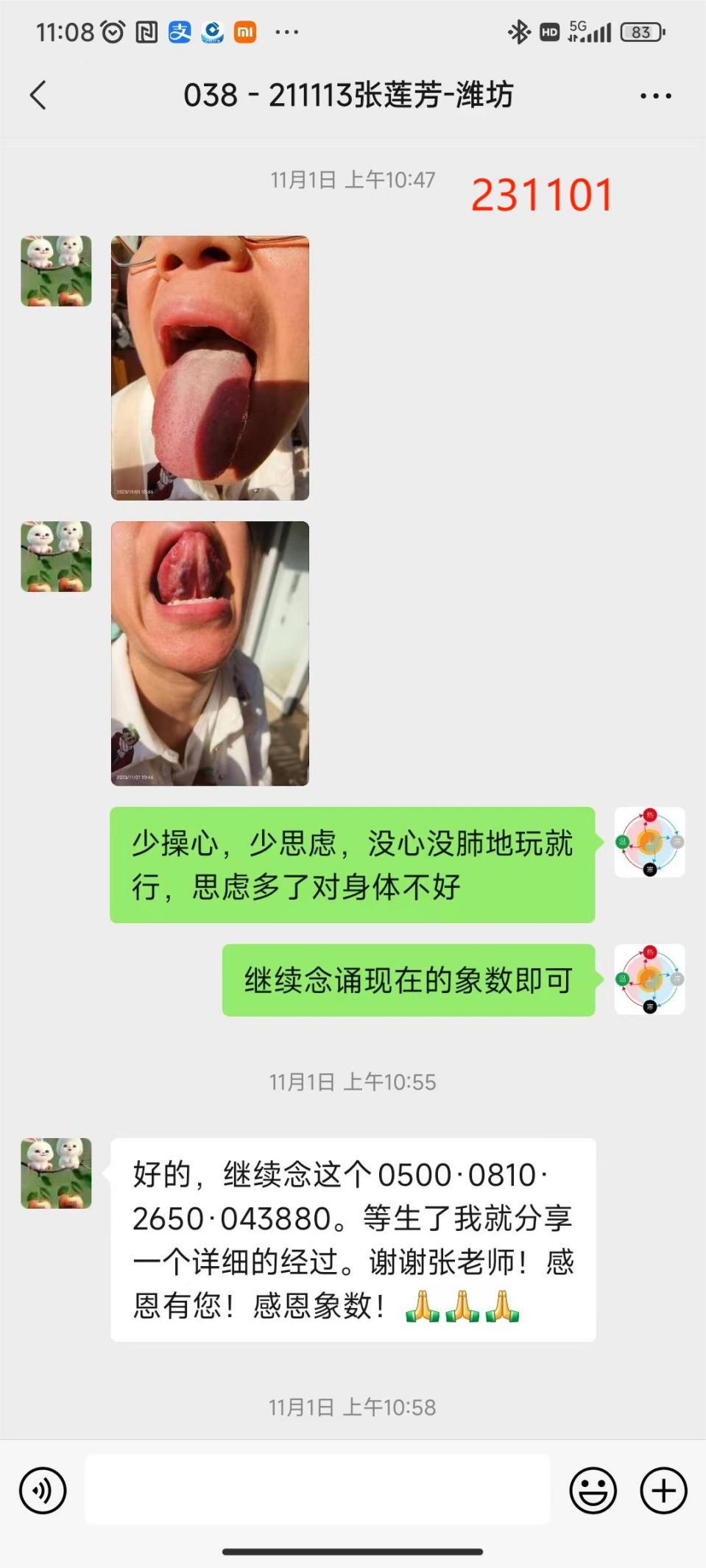 231202脐带绕颈-4
