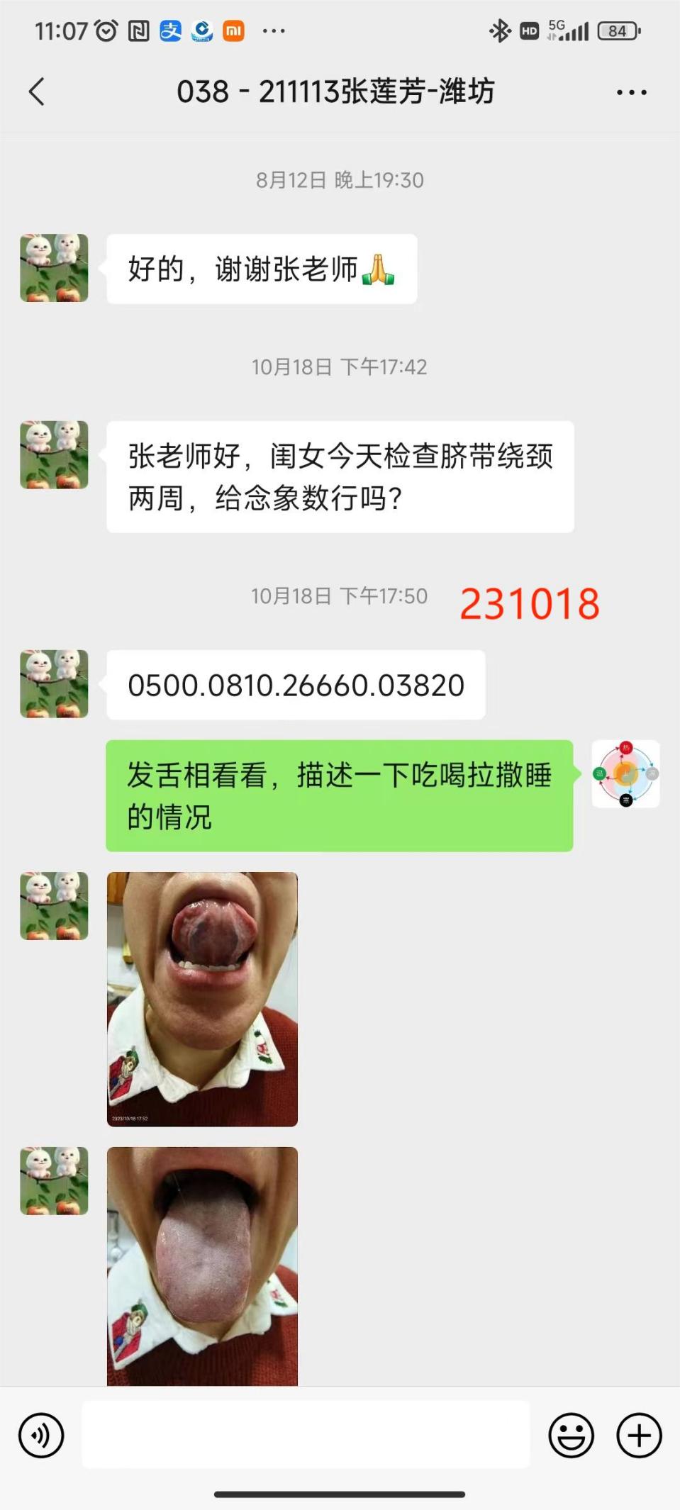 231202脐带绕颈-1