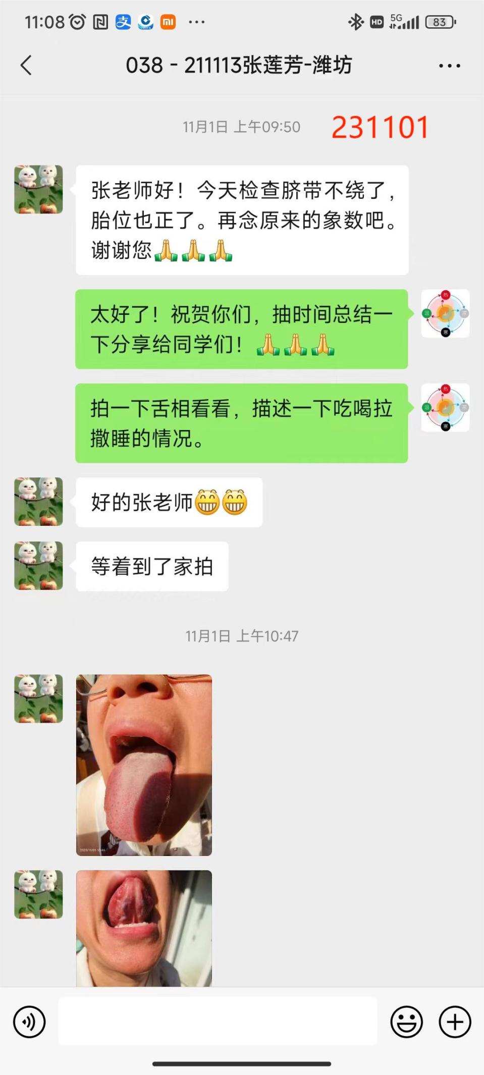 231202脐带绕颈-3