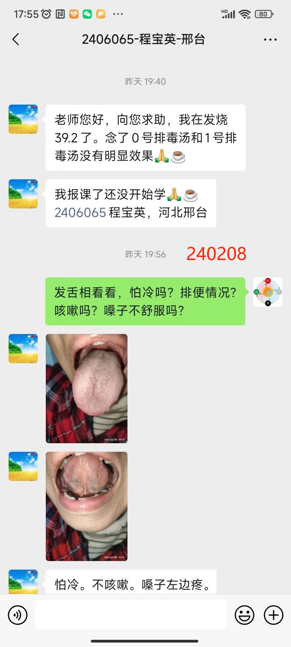 240209宝英感冒1