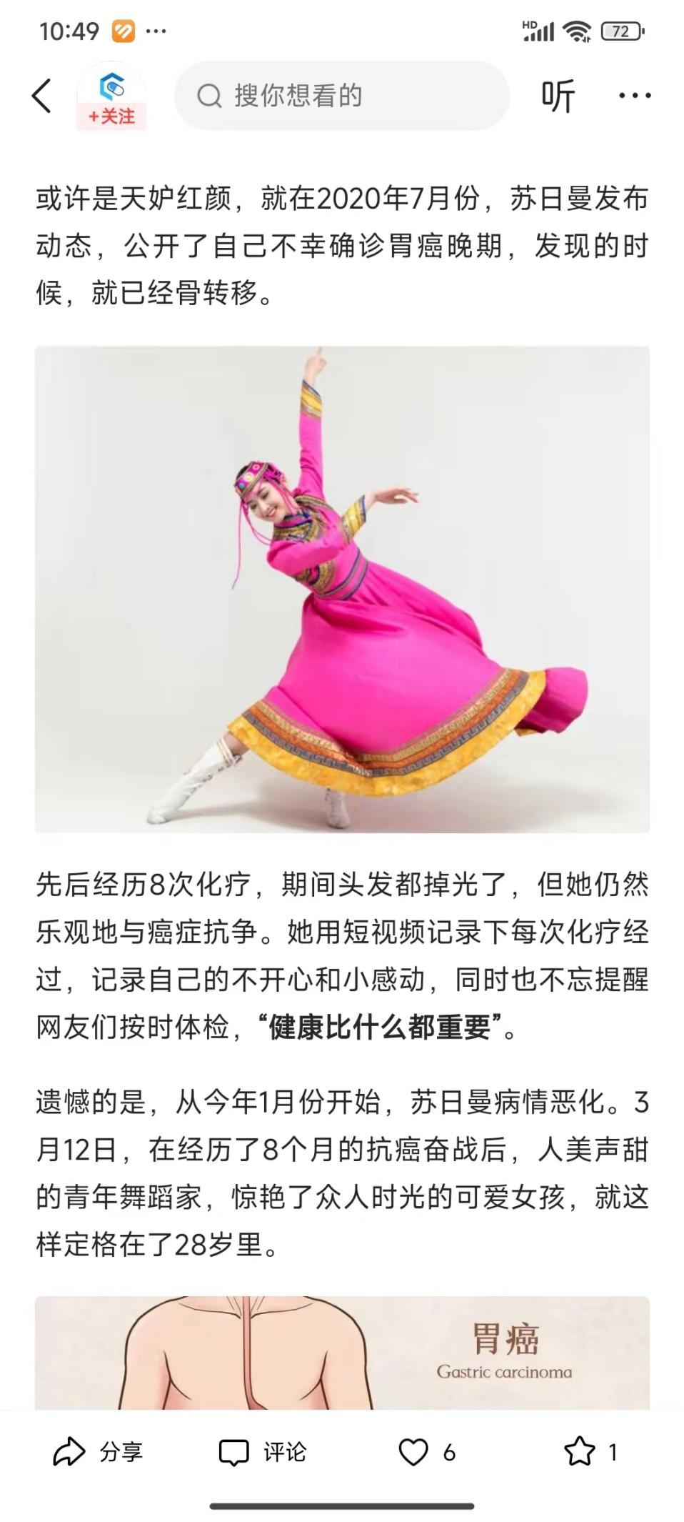 说明: 苏日曼胃癌7