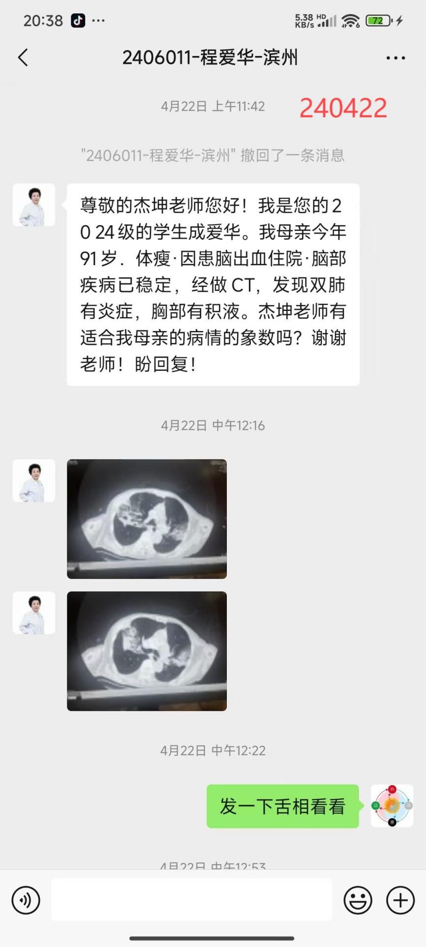 240818老人肺炎1