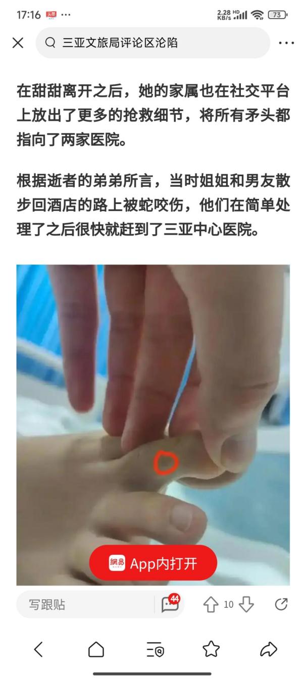 说明: 250612毒蛇咬伤3